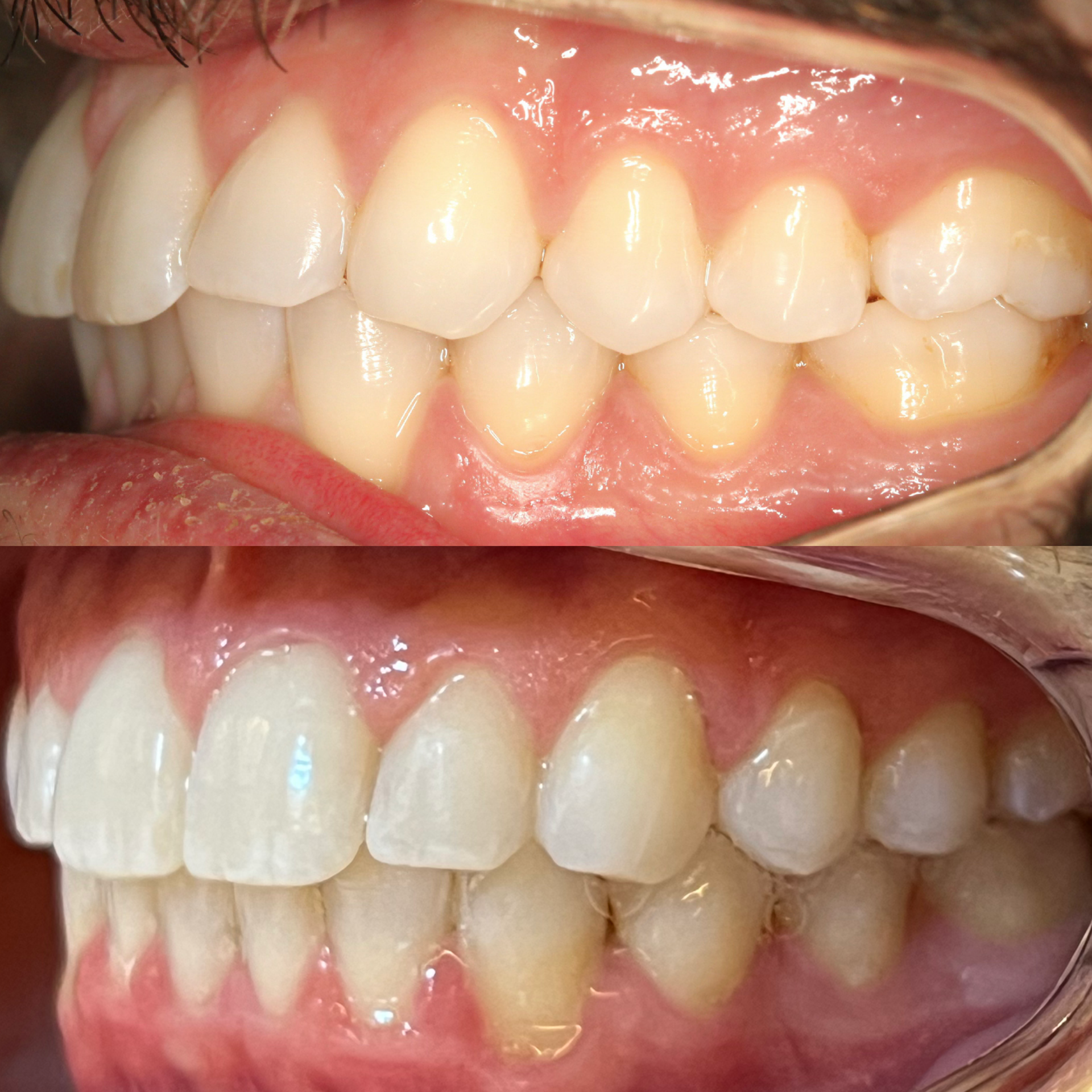 Caso real — Mordida e estética do sorriso